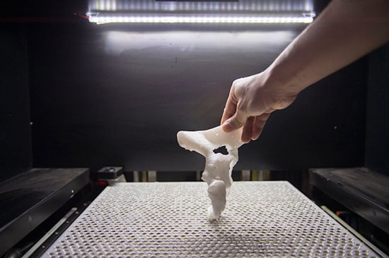 پیوند استخوان با چاپگر سه بعدی